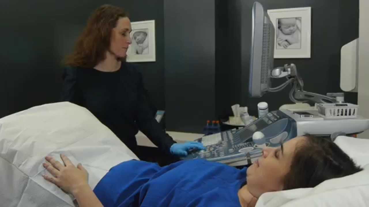 insemination ovo fertilite