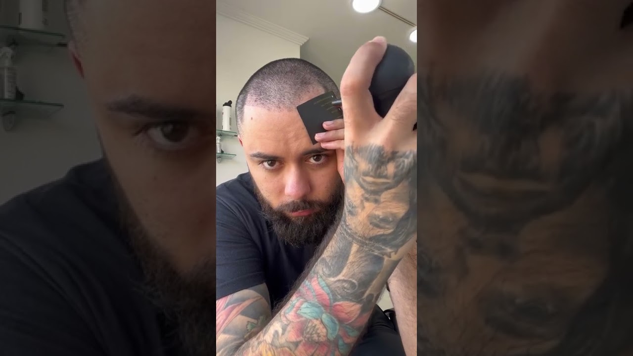 Como disfarçar a calvicie