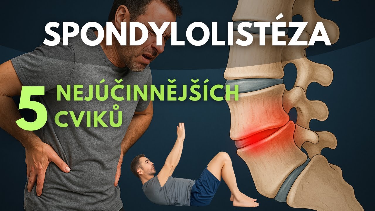 Spondylolistéza - 5 nejlepších cviků na „posunutý“ obratel