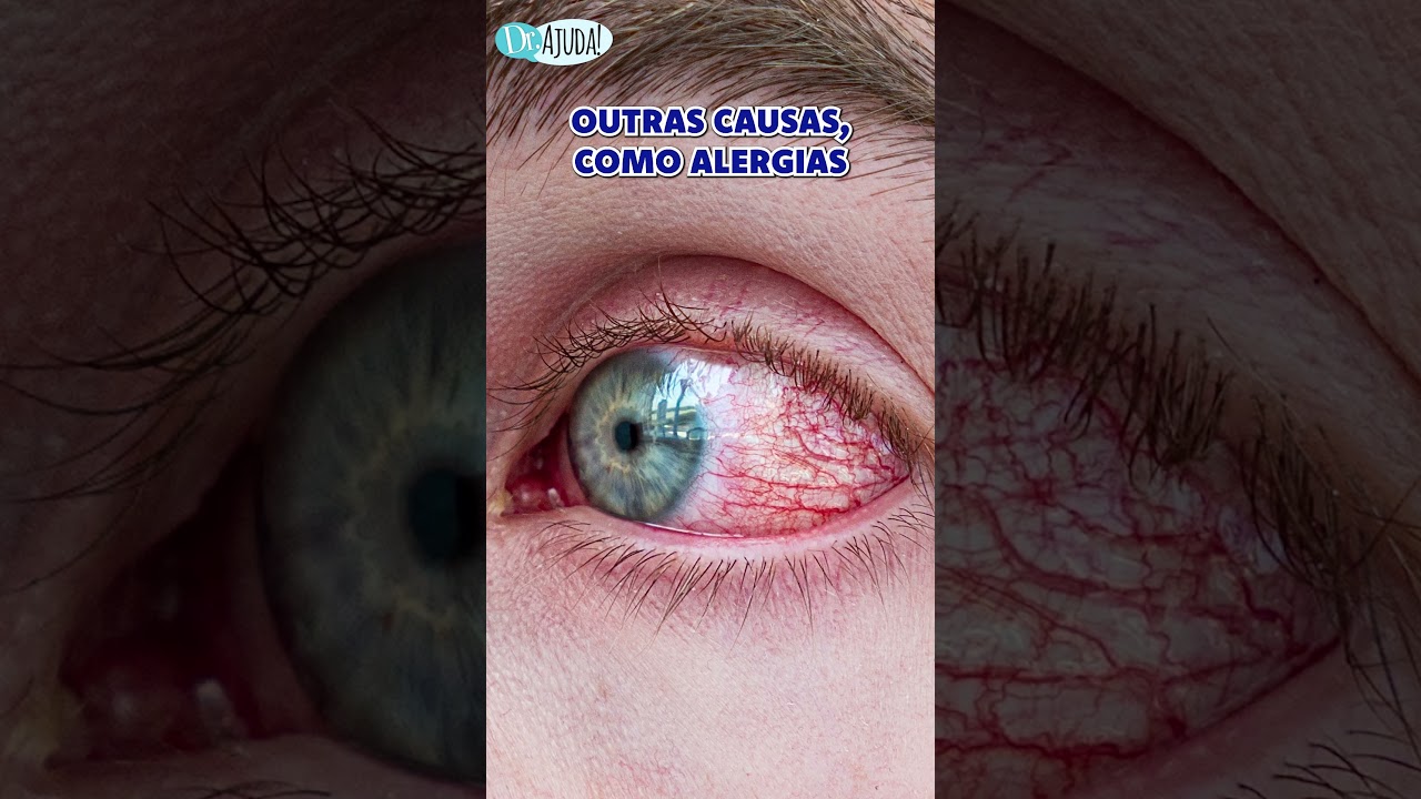 Olhos dão SINAIS DE DOENÇAS