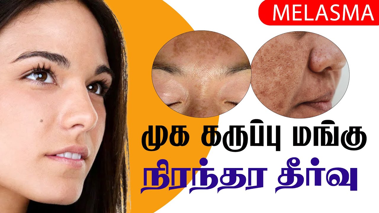 முக கருப்பு (மங்கு) நிரந்தர தீர்வு | MELASMA | JKT SKIN