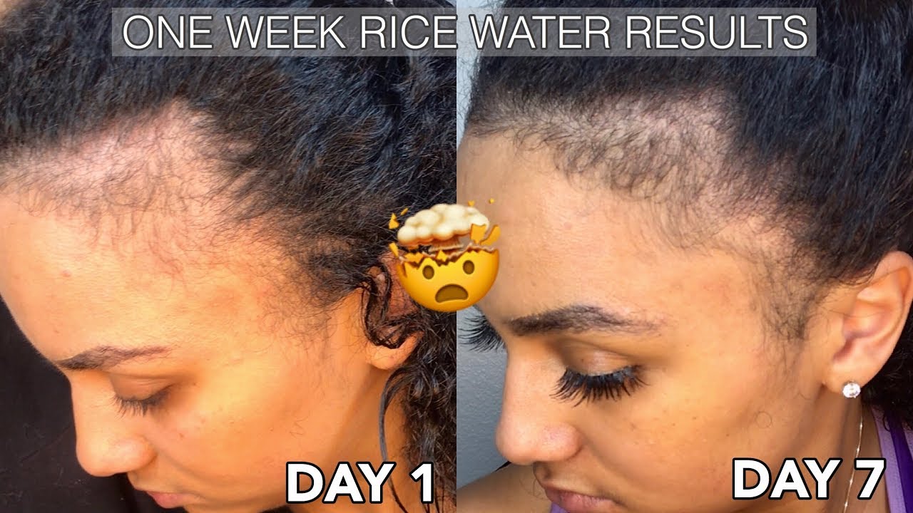 HOW TO GROW YOUR EDGES USING RICE WATER IN 1 WEEK! BEFORE AND AFTER RICE WATER RESULTS