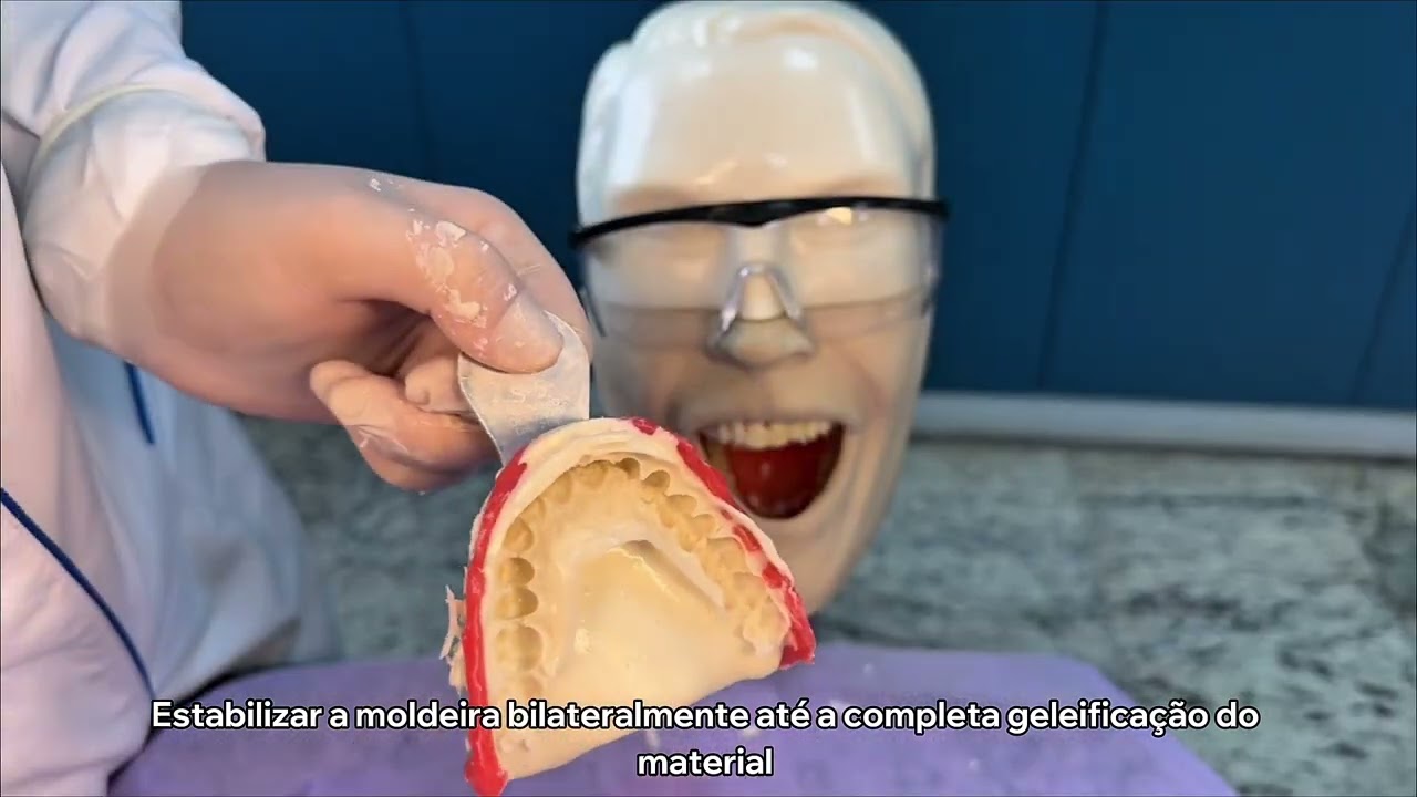 Moldagem em alginato, confec&ccedil;&atilde;o de modelo de gesso e placa de clareamento