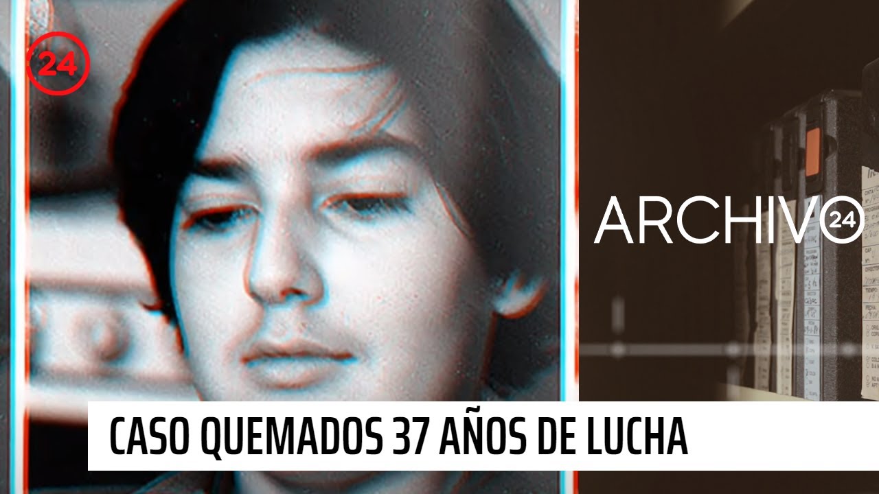 Archivo 24 | Caso Quemados: 37 años de lucha por justicia