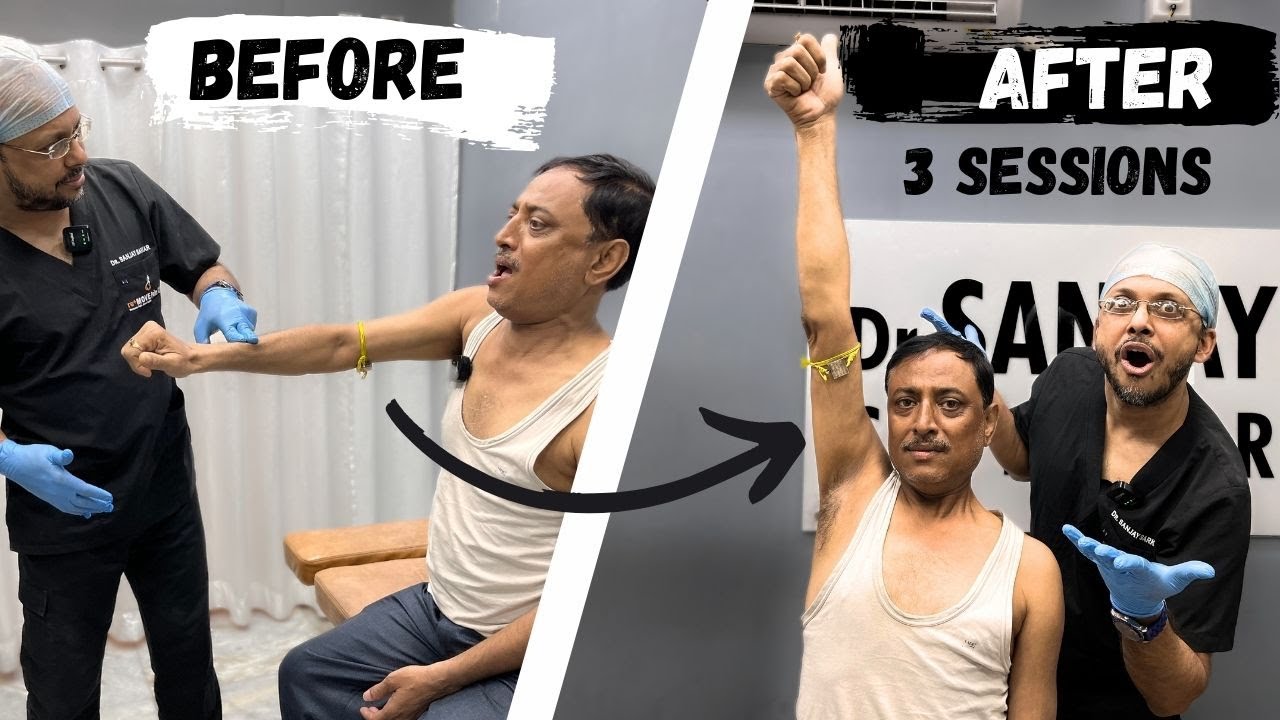 Unlocking Frozen Shoulder with Chiropractic Treatment and Popping Techniques!