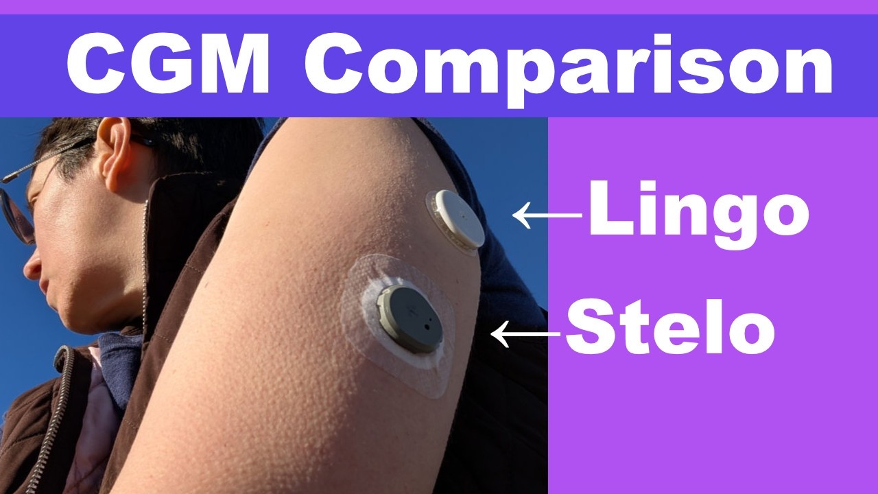Dexcom Stelo против Abbott Lingo — какой безрецептурный CGM лучше?