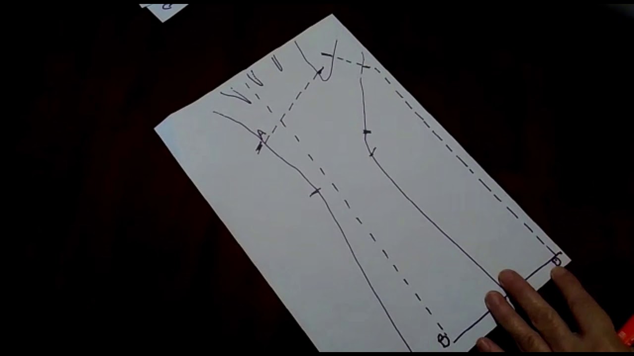 Órtesis estática larga, radial para tenosinovitis de pulgar.
