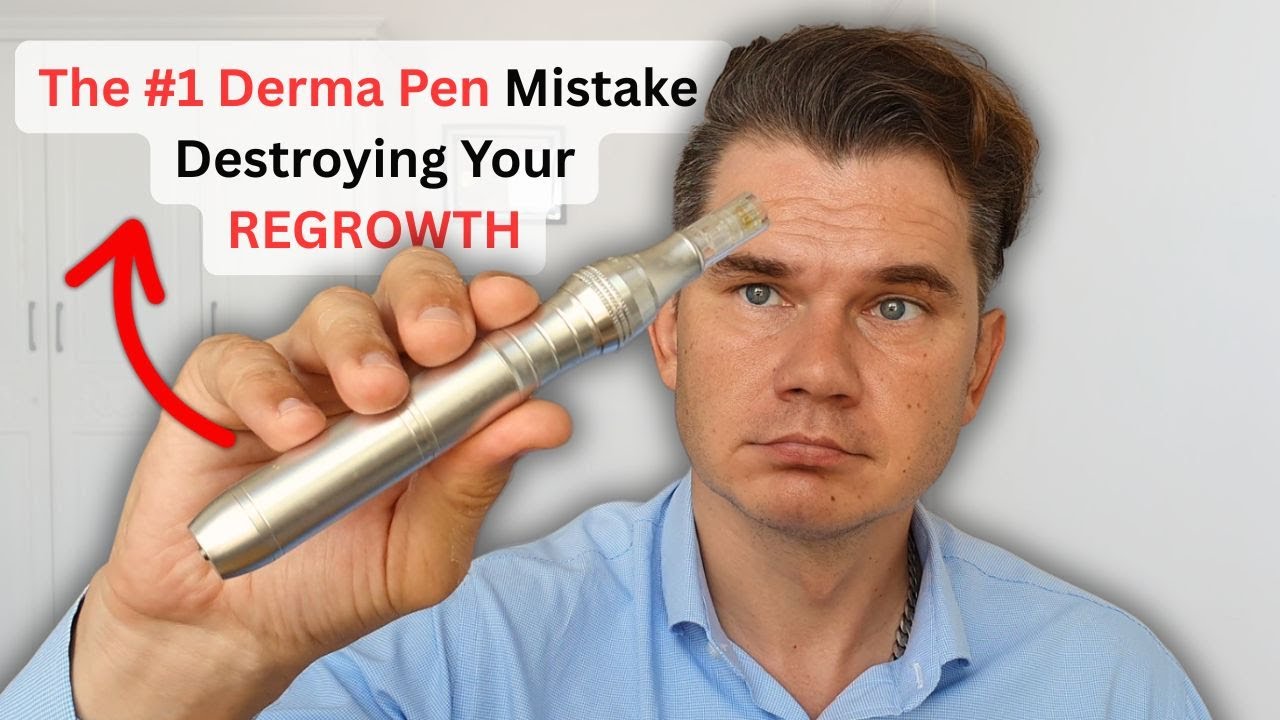Błąd z DERMA PEN, kt&oacute;ry popełniają wszyscy (jak temu zaradzić, aby włosy odrosły)