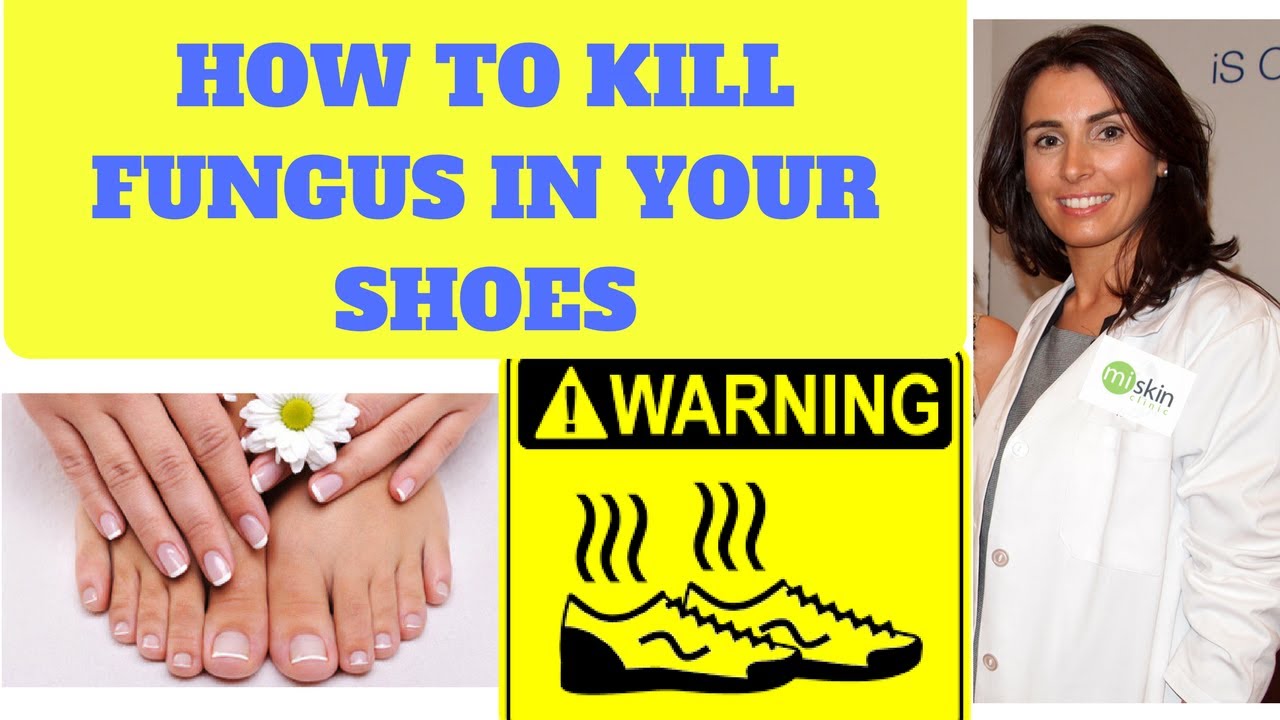 Sterilising Shoes for Fungal nail infections