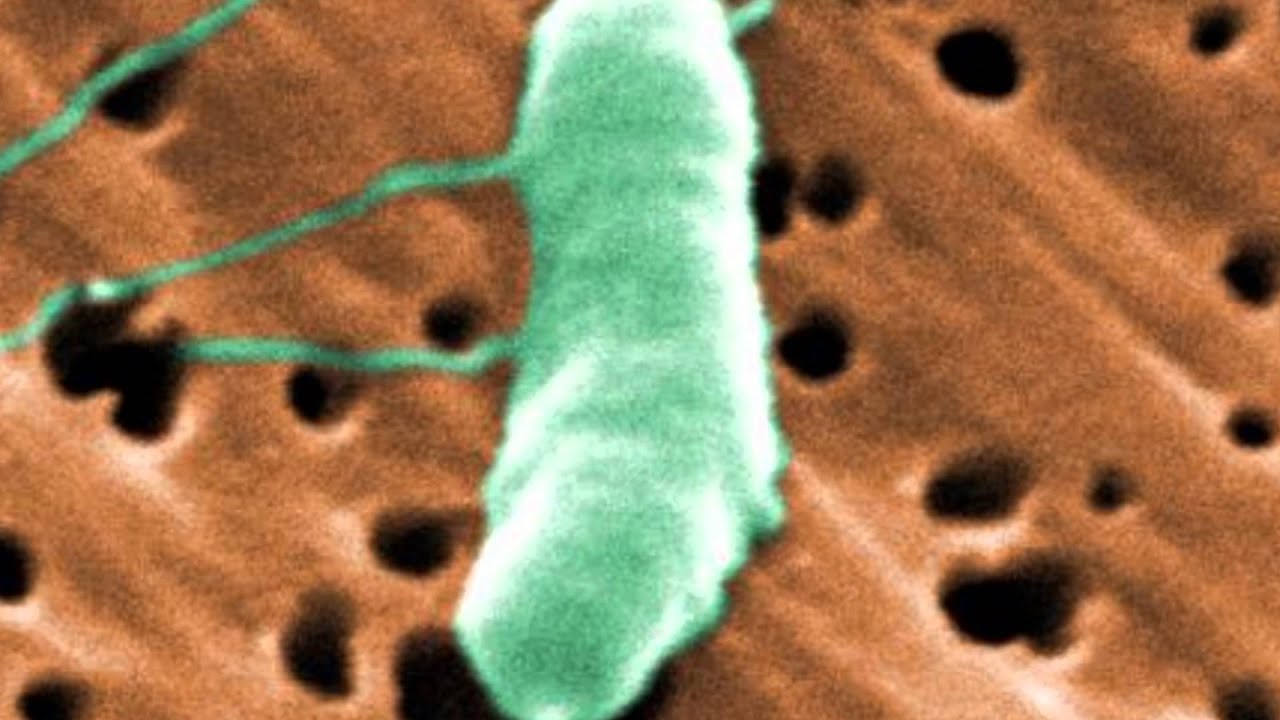 Vibrio vulnificus: What You Need To Know