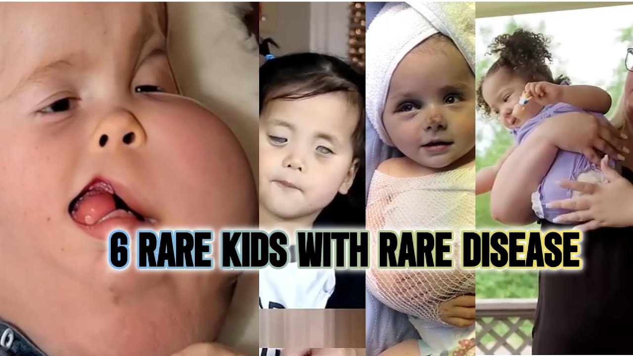 Stories of 6 Kids with Rare Diseases