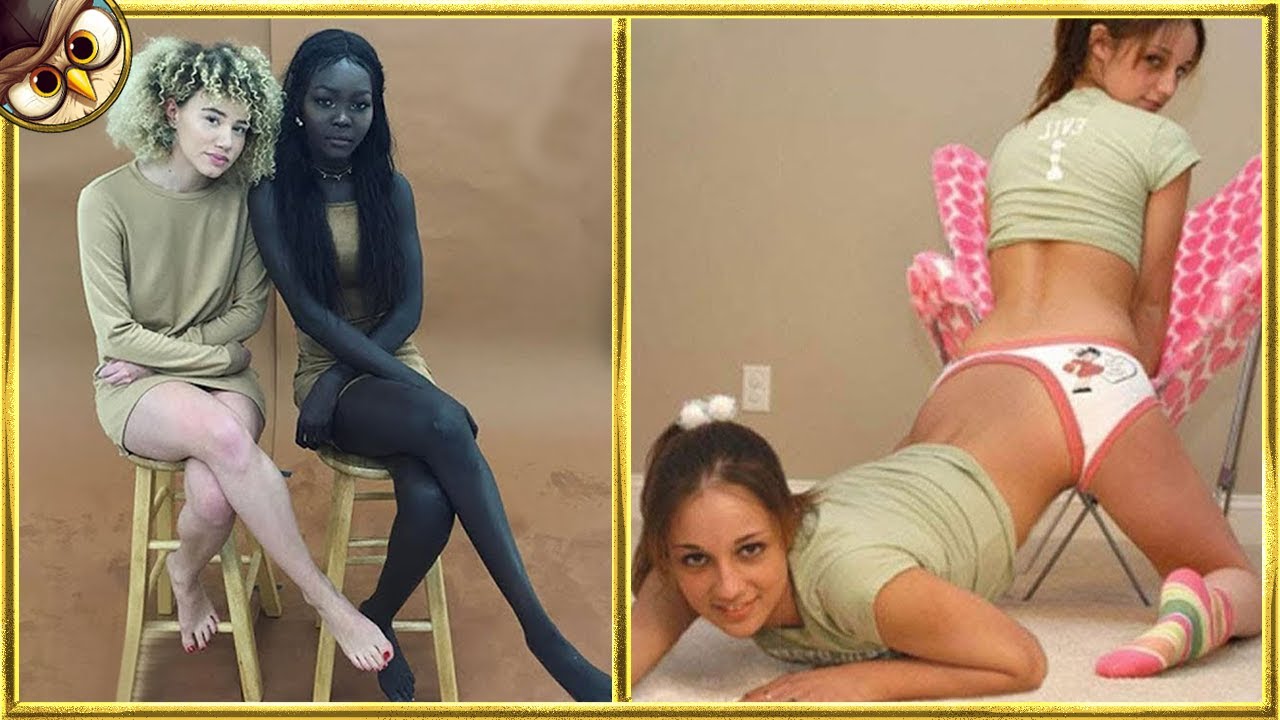 20 Twins Who Are Only Born Once in a Thousand Years