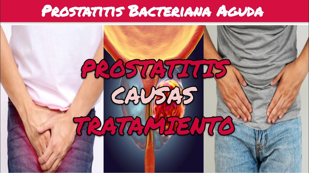 ⚕️🩺 PROSTATITIS BACTERIANA AGUDA SÍNTOMAS Y TRATAMIENTO