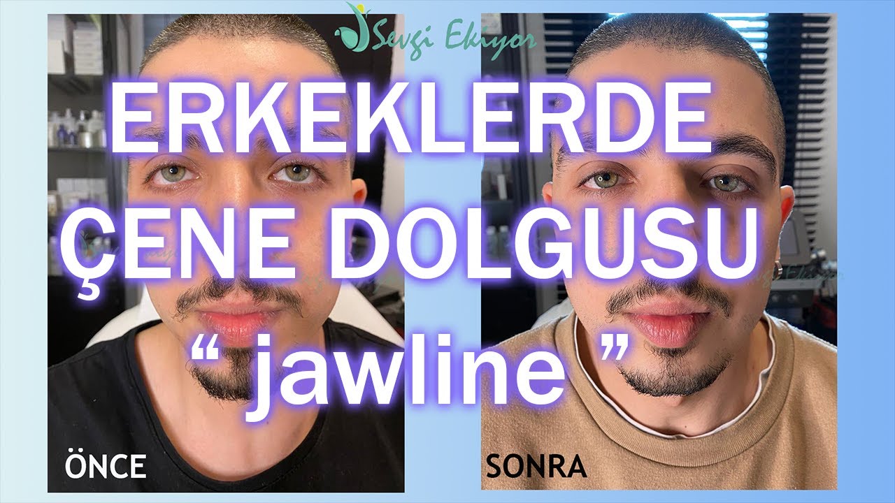 Erkekte Jawline Uygulaması
