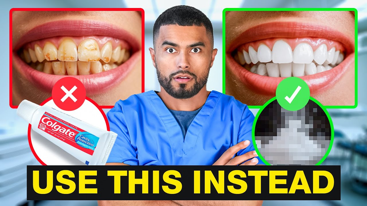 How To Fix Your Teeth (Use At Home Products)