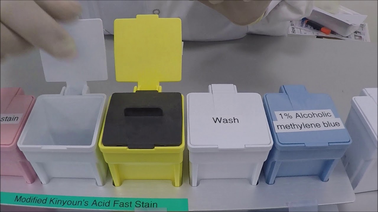 Kinyoun's staining for cryptosporidium