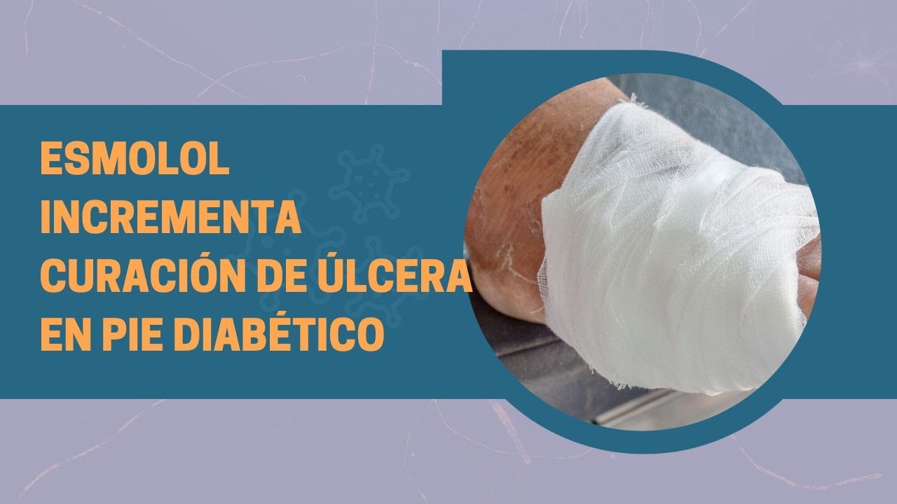 Esmolol incrementa curación de úlcera en pie diabético