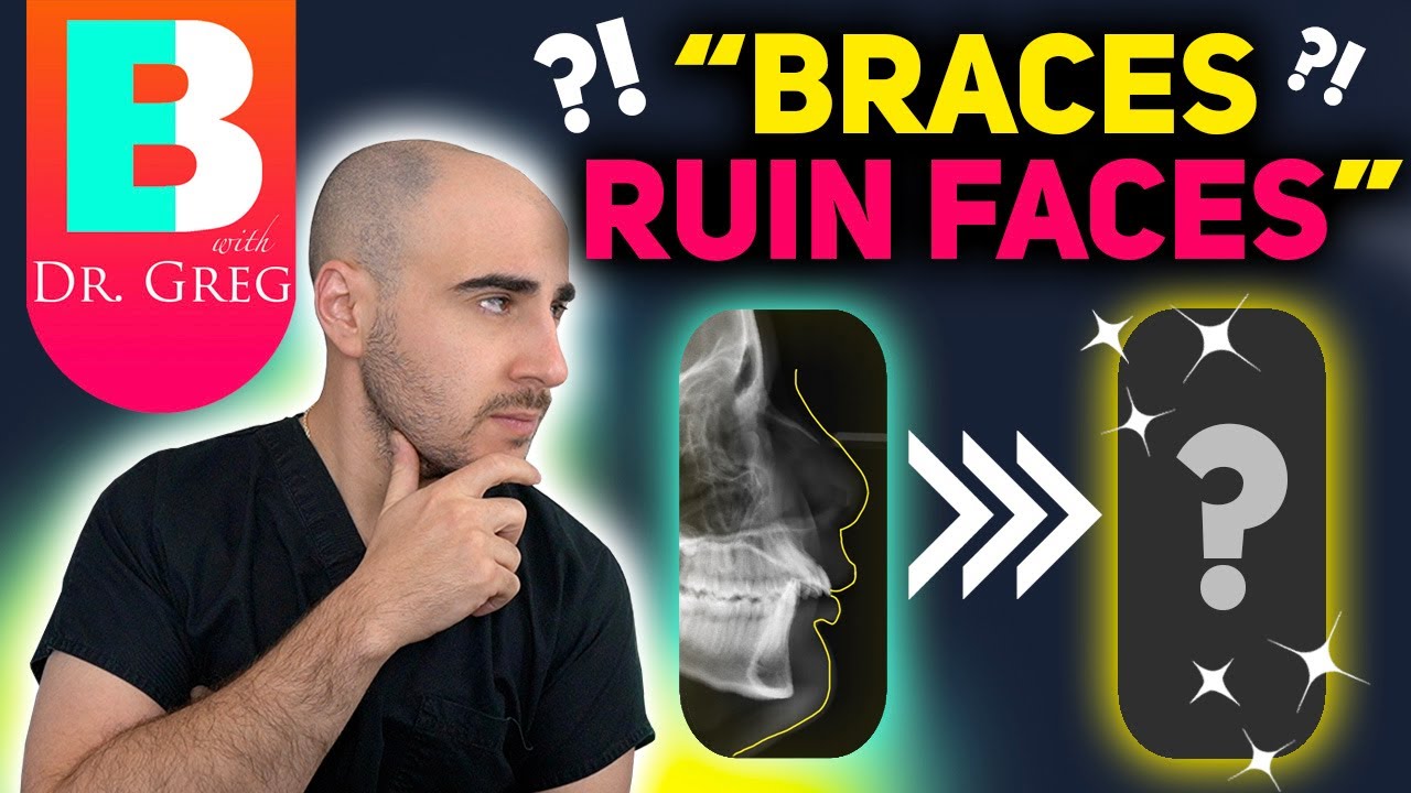 Braces Extractions DO NOT Ruin Faces!
