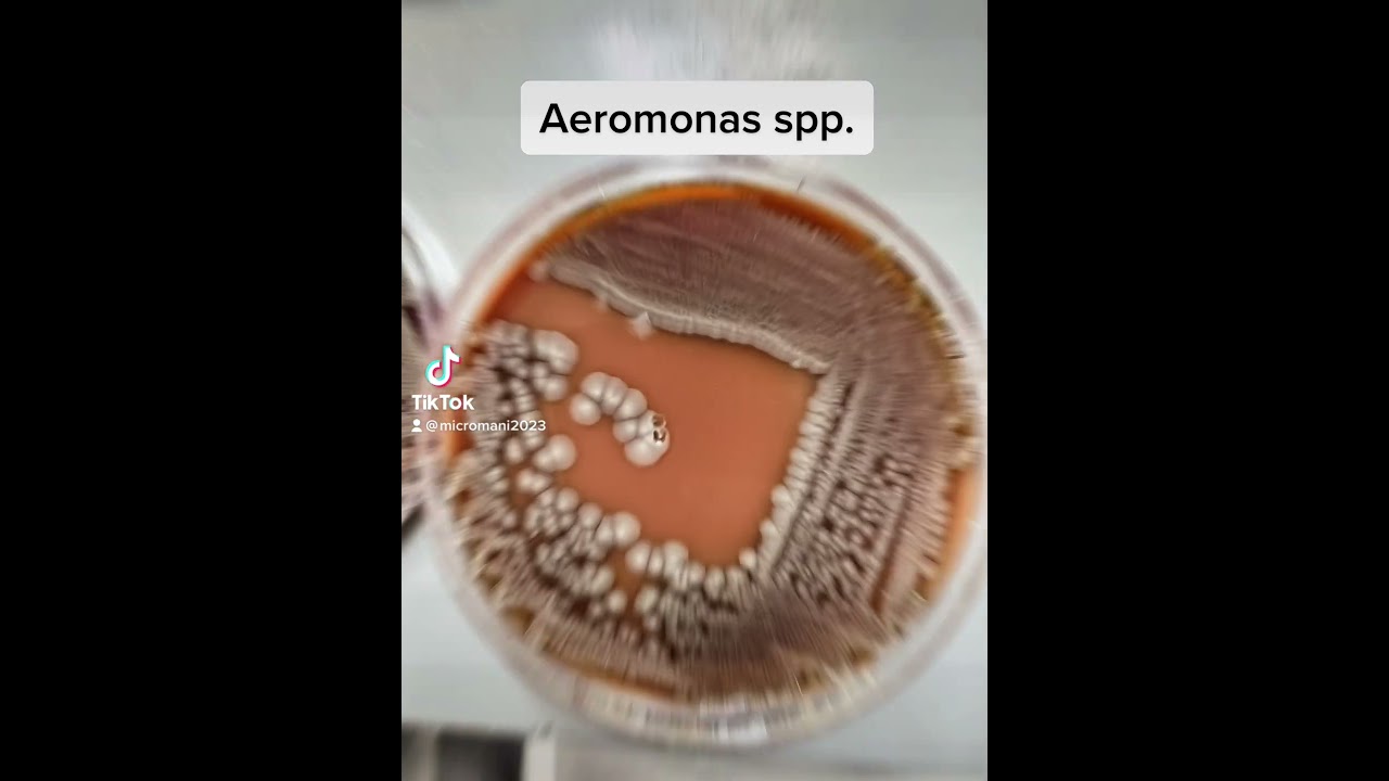 Aeromonas #labtech #microbiology #bacteria #medicallaboratory #laboratory #medtech #learning