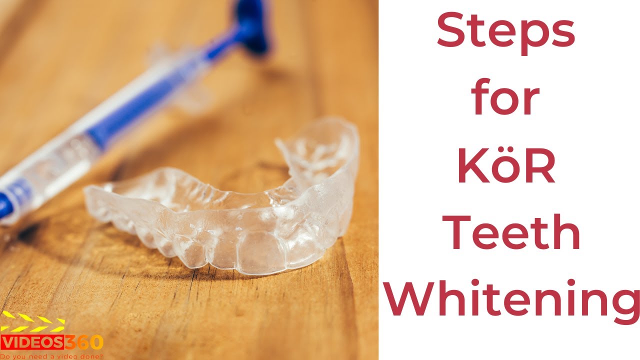 Steps to using your KöR Teeth Whitening Kit - Alpharetta Smile Care