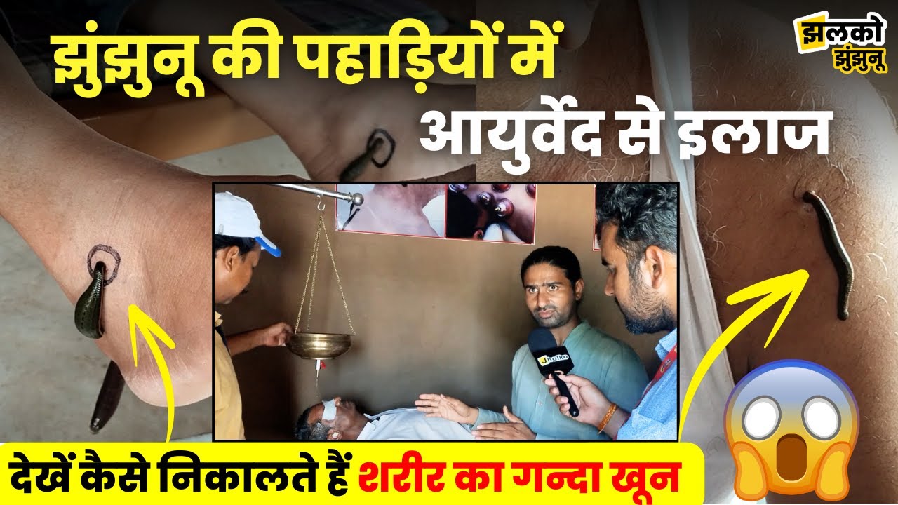 झुंझुनू की पहाड़ियों के बीच बने आयुर्वेदिक आश्रम में जानवर निकालते हैं शरीर का गन्दा खून, देखें कैसे
