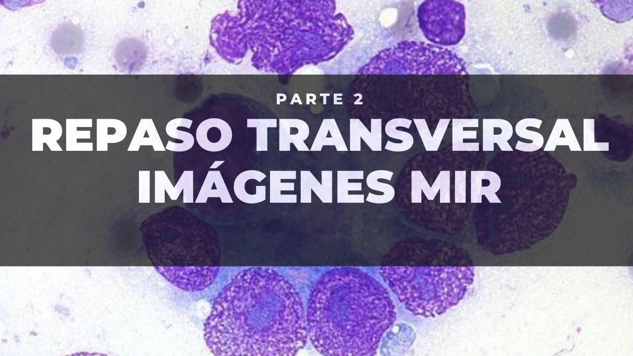 Repaso transversal de IMÁGENES MIR #2