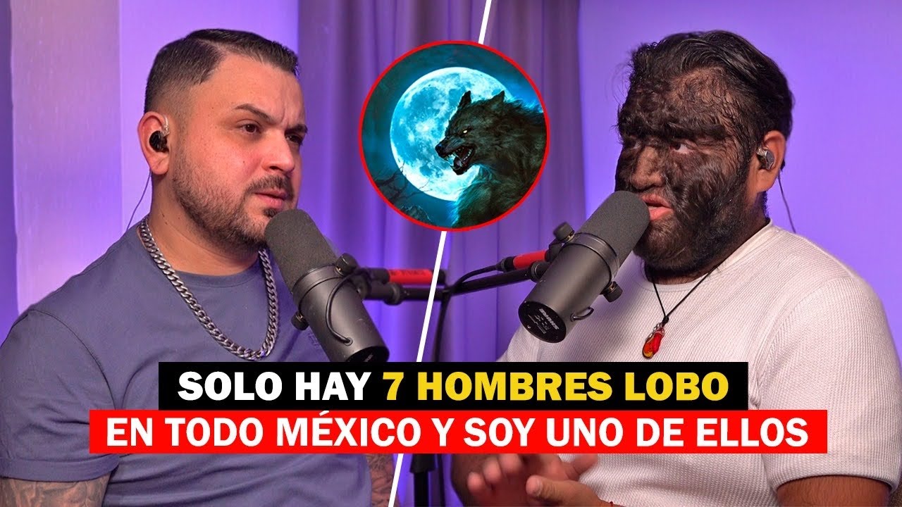 MI VIDA COMO HOMBRE LOBO Y PORQUE NAC&Iacute; AS&Iacute; | Alex # 290