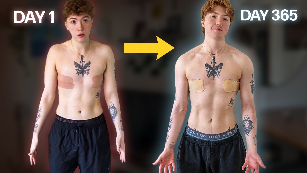 FTM 1 year on testosterone (FULL documentation)