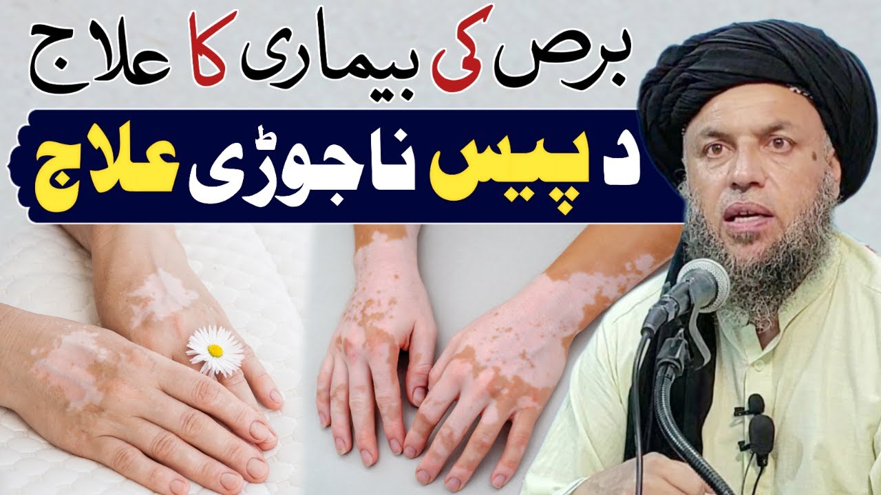 Bars Ki Bimari Ka Qurani ilaj | Phulbehri Ka ilaj | Powerful Wazifa | Maulana Noor Uddin Agha