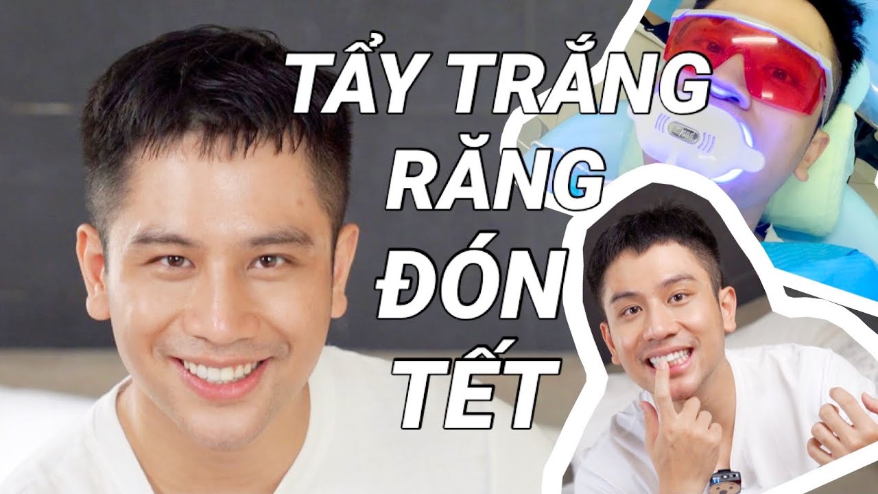 TẨY RĂNG CÓ ĐAU KHÔNG? QUÁ TRÌNH TẨY RĂNG TỪ A Đến Z - làm đẹp đón Tết // Dinology