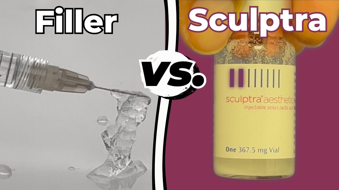 Sculptra- The Best Kept Secret! 🤫| Sculptra Vs. Filler