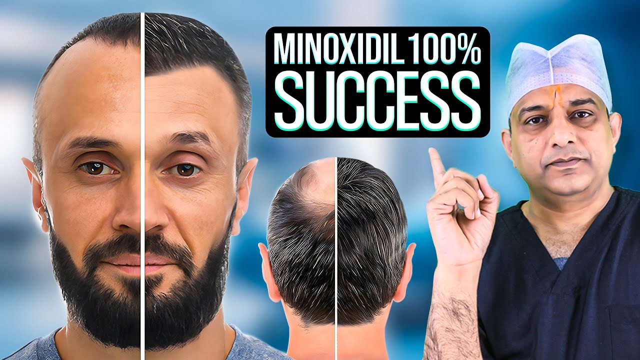 MINOXIDIL after Hair Transplant - Full Step-by-Step Guide for Hair Growth Tips | Saraswat Hospital