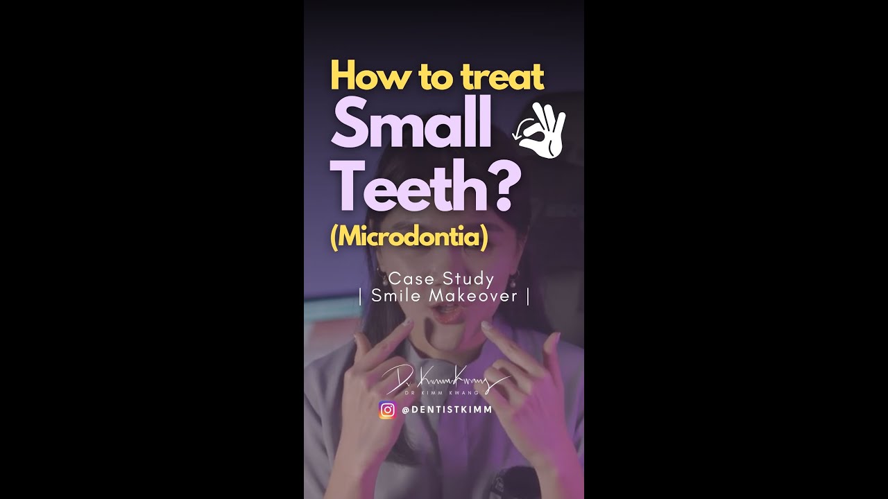 Why are my teeth so small ｜ Microdontia ｜为什么我的牙齿那么小颗？ 如何解决？ | DentistKimm