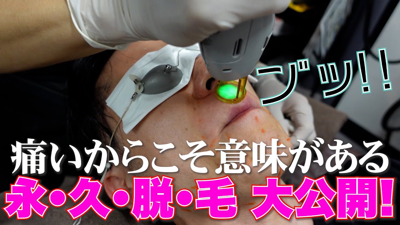 【密着】アナウンサーのヒゲ脱毛風景をお見せします。