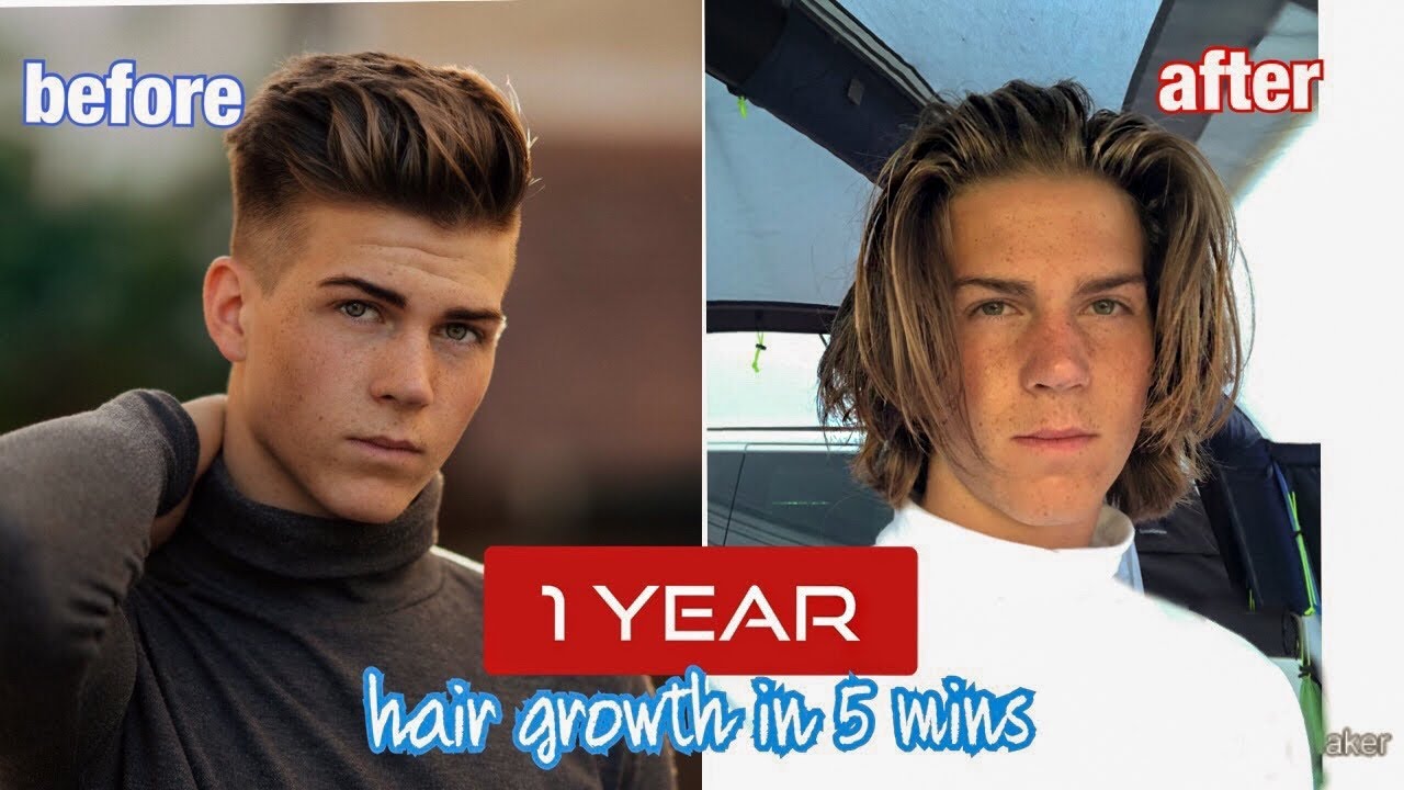 Hair Growth Time  Lapse - 1 Year (undercut)