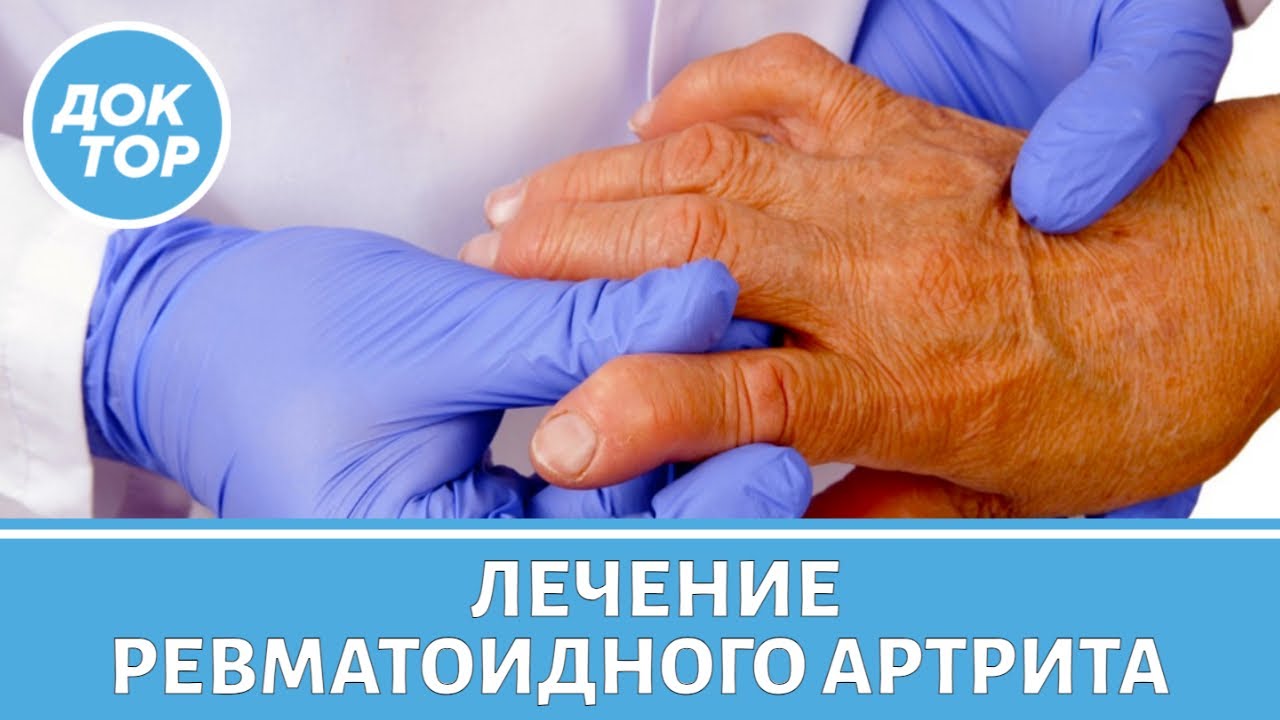 Современные методы лечения ревматоидного артрита