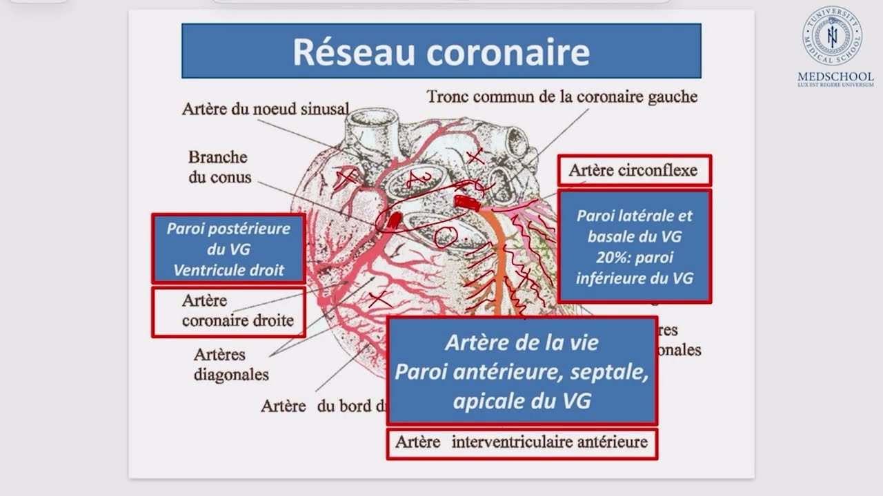 🔴 Extrait de séance en direct — Objectif 65 : Syndromes coronariens aigus