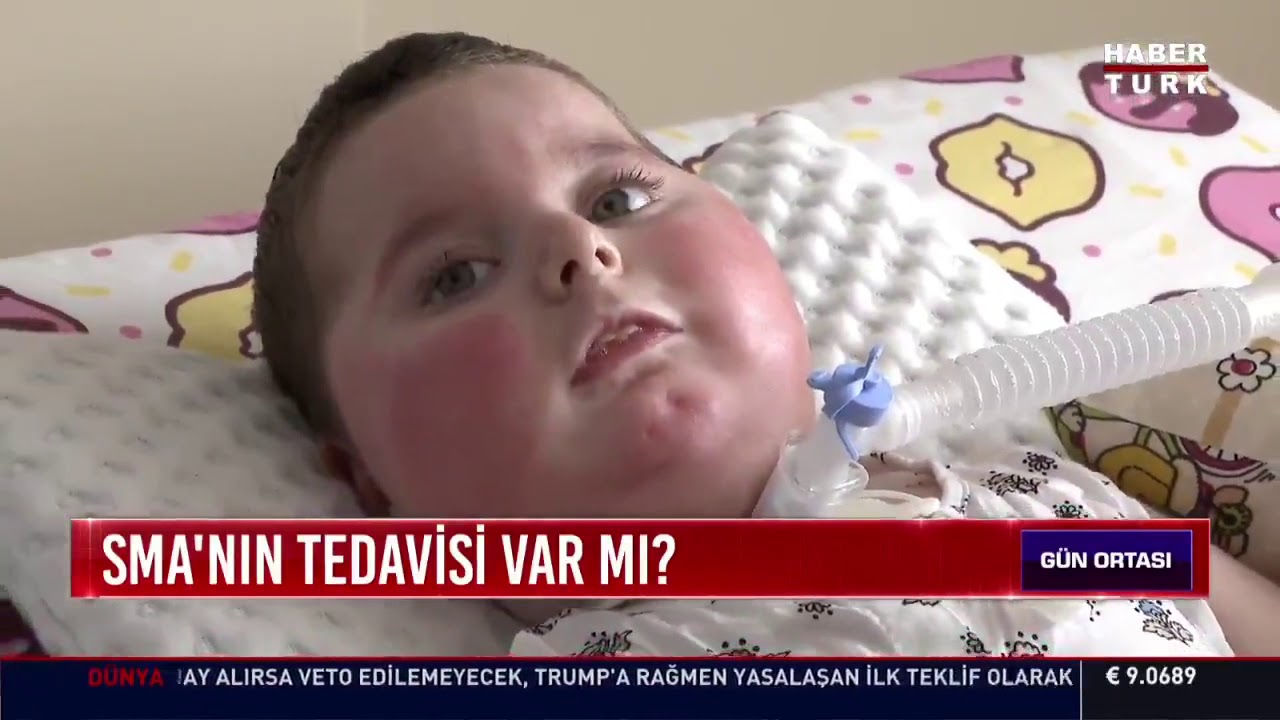 SMA'nın tedavisi var mı?
