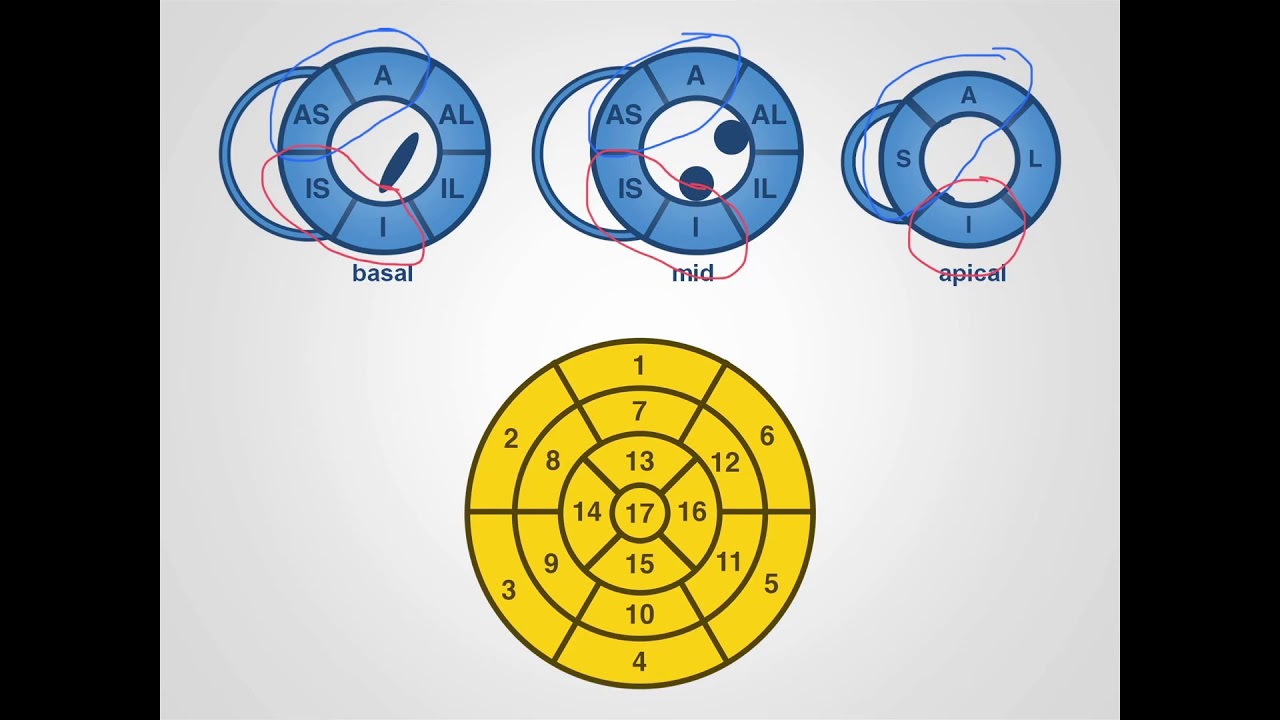 The fundamentals of left ventricular assessment in cardiac magnetic resonance imaging (CMR)