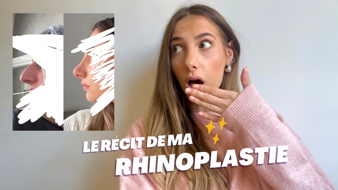 Le récit de ma rhinoplastie (ratée)