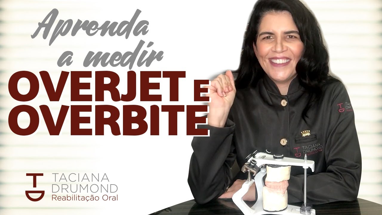 Overjet e Overbite - O que é e como medir? | Análise oclusal
