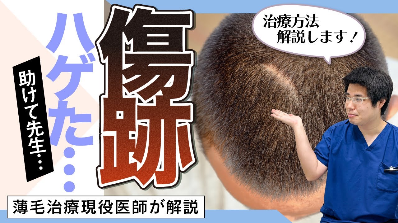 【薄毛治療】現役医師が完全解説！ケガして髪の毛が生えてこなくなったときは…！？【湘南AGAクリニック名古屋院】