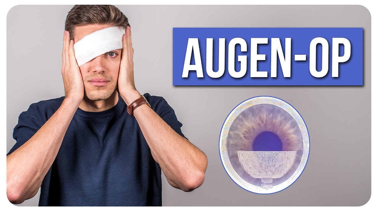 Sehschärfenkorrektur - LASIK Operation - Doc Mo