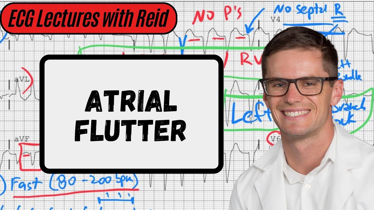 Atrial Flutter | Day 11 ECG Challenge