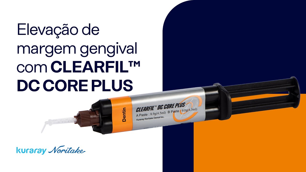 Elevação de Margem Gengival com CLEARFIL™  DC CORE PLUS | Kuraray Noritake