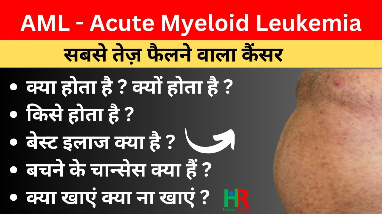 AML (acute myeloid leukemia ) cancer in hindi | AML cancer diagnosis in hindi | aml symptoms hindi