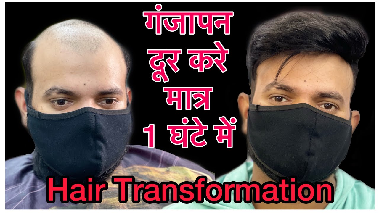 Hair Patch For Men In Lucknow | Hair Transformation In Lucknow | Hair wigs shop | Rizy Hair | #wigs