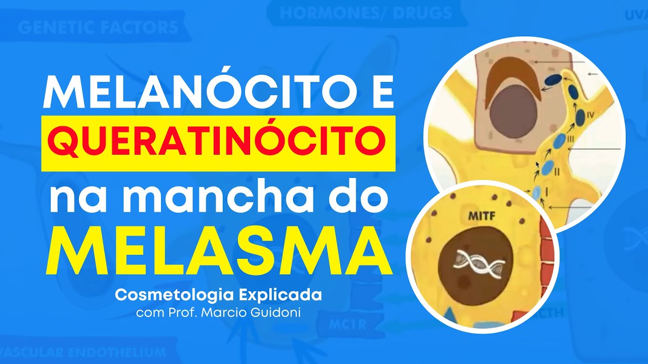 MELANÓCITO E QUERATINÓCITO NA MANCHA DE MELASMA | Cosmetologia Explicada com Prof. Marcio Guidoni