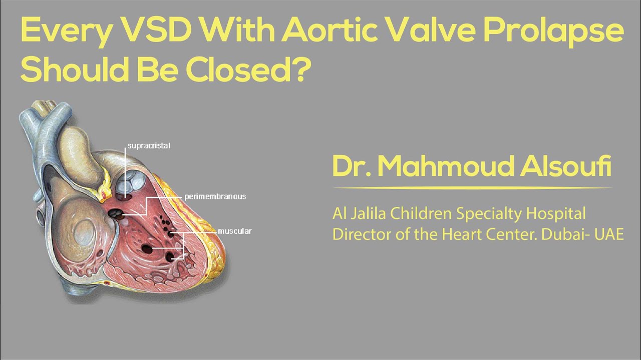Every VSD With Aortic Valve Prolapse Should Be Closed?