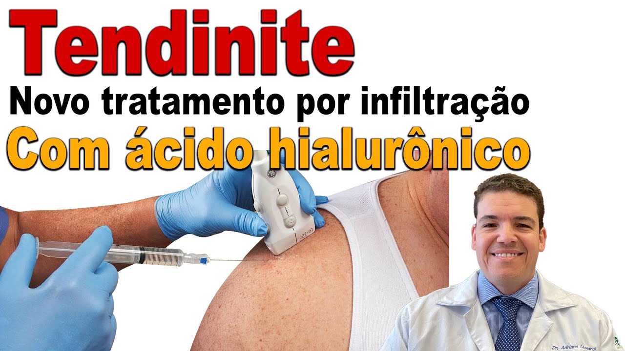 Tendinite: NOVO TRATAMENTO por infiltração com ácido hialurônico